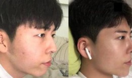 整容爆料大全视频播放网站,热门视频网站深度解析